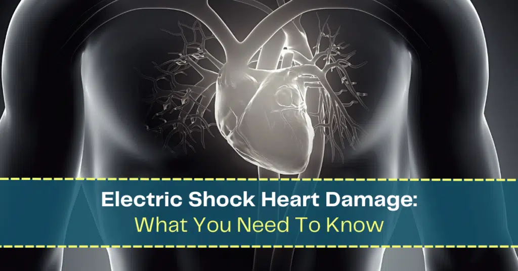 Electric Shock Heart Damage: What You Need To Know