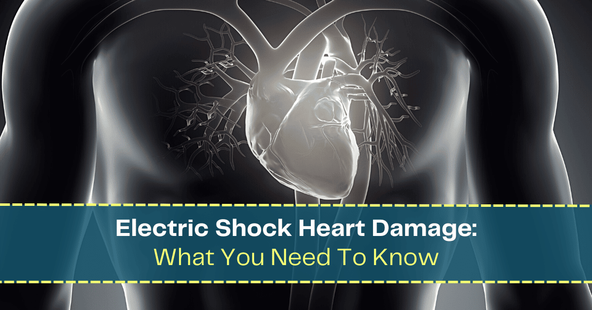 Electric Shock Heart Damage What You Need To Know