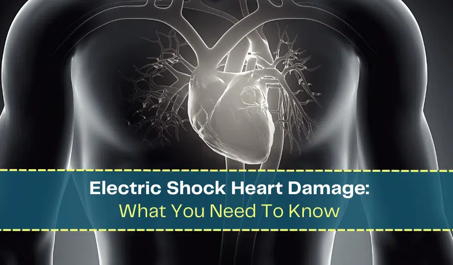 Electric Shock Heart Damage What You Need To Know