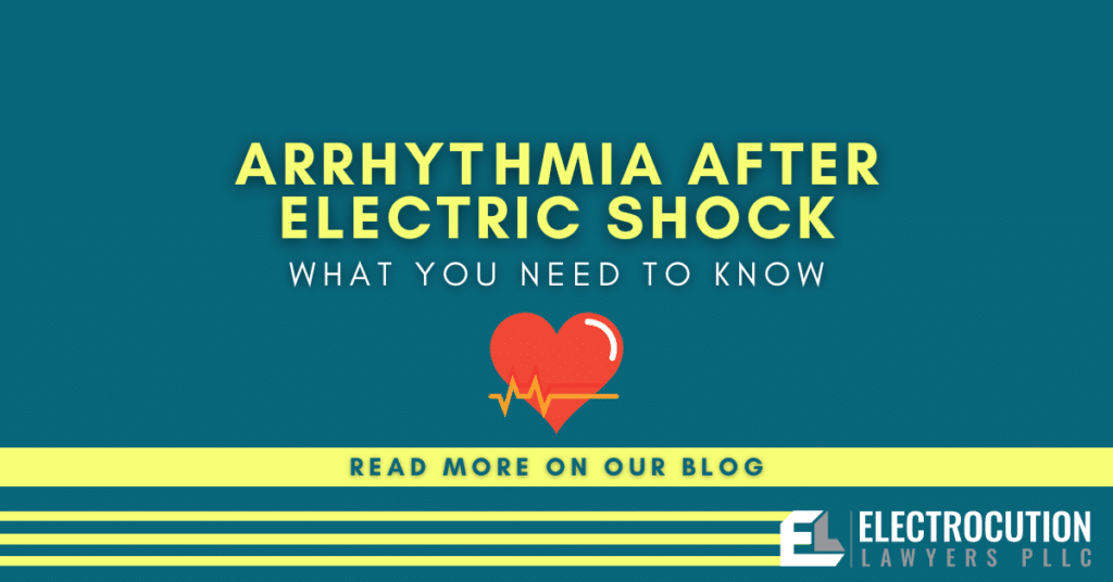 Arrhythmia After Electric Shock: What You Need To Know
