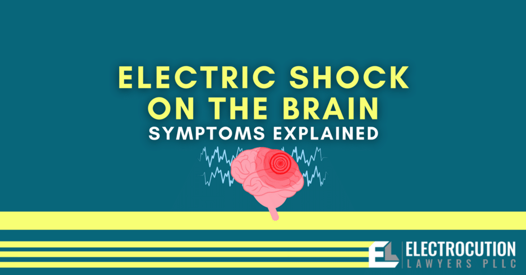 Effects of Electric Shock On The Brain Explained