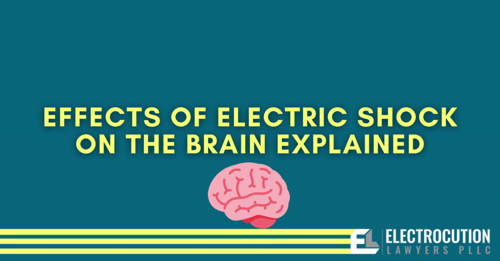 Effects of Electric Shock On The Brain Explained