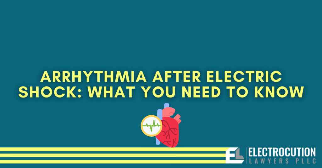Arrhythmia After Electric Shock: What You Need To Know