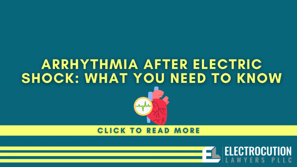 Arrhythmia After Electric Shock: What You Need To Know